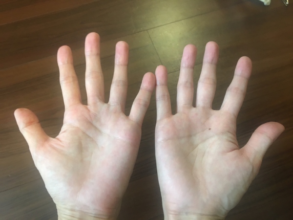 きくち体操 コラム
